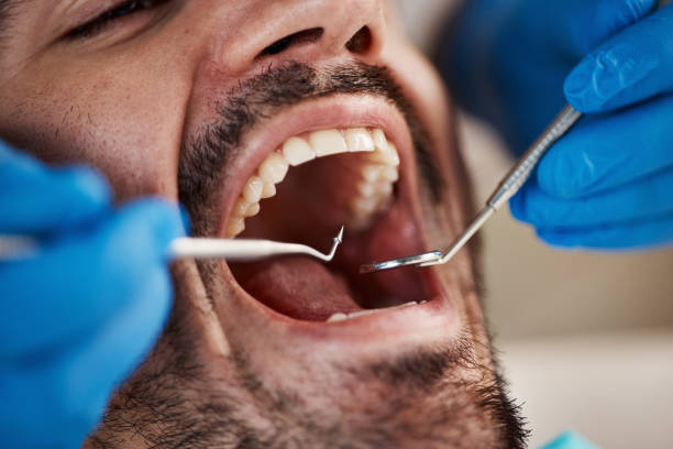 Fast & Reliable Emergency Dental Services in RI